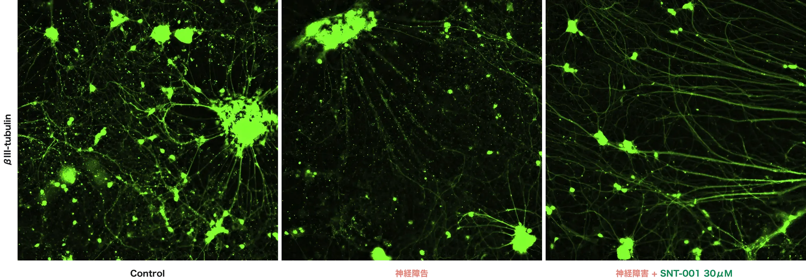 ヒトiPSC由来感覚ニューロンにおける神経突起伸展 βIII-tubulin - Control/神経障害/神経障害+SNT-001 30μM