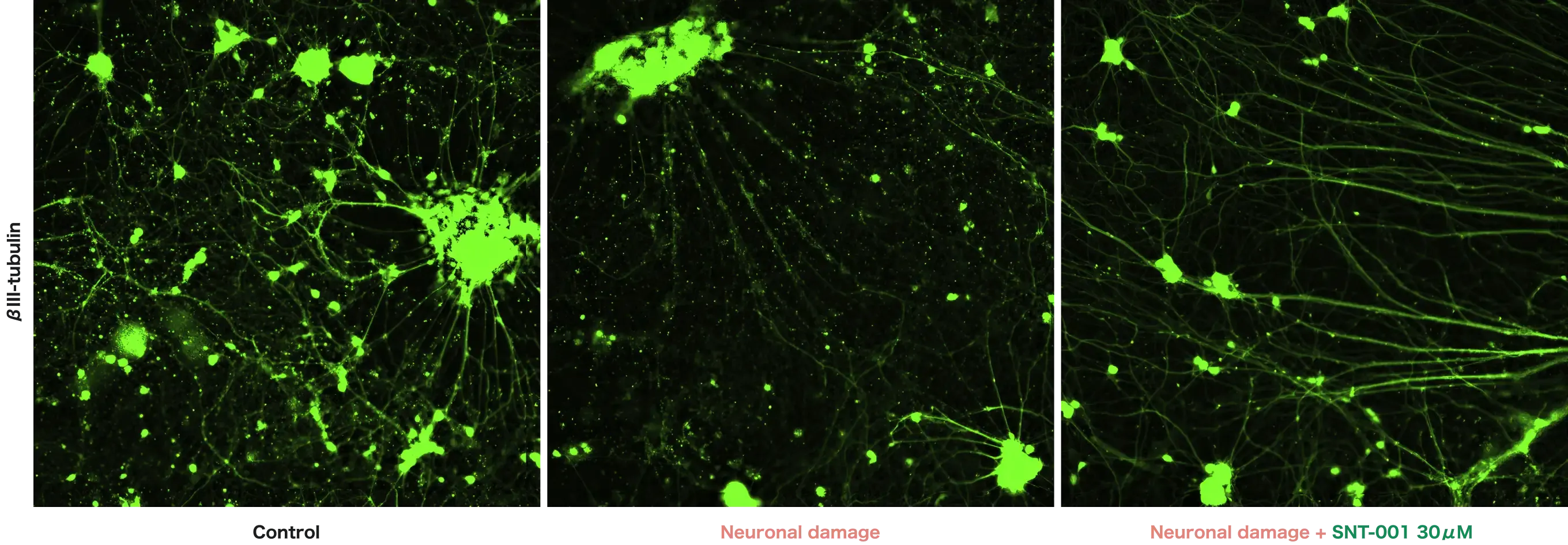 Neurite outgrowth in human iPSC-derived sensory neurons βIII-tubulin - Control/Paclitaxel-/Oxaliplatin-+SNT-001 30μM